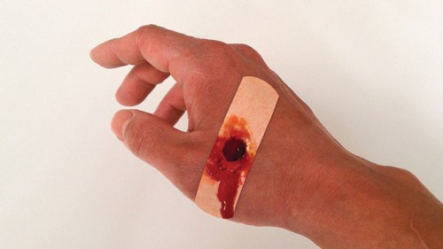 Booboos-Bandaids-look-like-Wounds-Should-Come-In-Different-Skin-1
